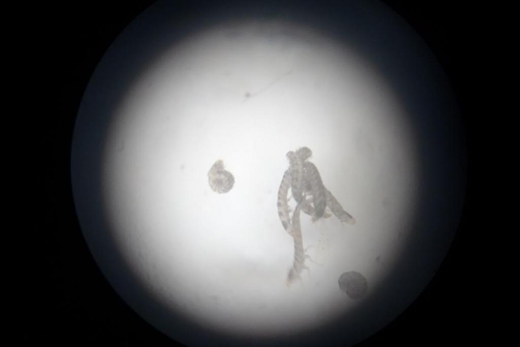 顕微鏡で見ると確かに幼虫です